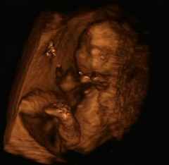 Semana 16 del embarazo ecografia 3D